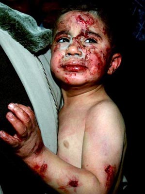 اليورانيوم المنضب والفسفور الأبيض.. غزة مصرحا لتجارب الأسلحة الأمريكية