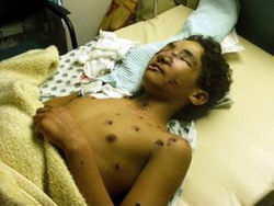 أوكامبو يدرس إمكانية محاكمة مجرمي الحرب الإسرائيليين