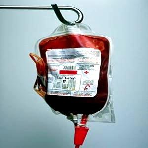 200 مصابا بالايدز..المريض يكلف الحكومة 250 دينارا شهريا