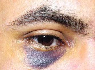 تعرض مدير مياه عين الباشا للضرب من موظفين