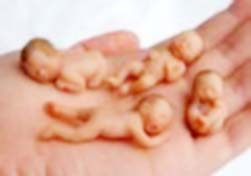 تونسية حامل بـ12 جنينا