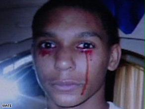 حالة عجز العلم عن تفسيرها: صبي أمريكي يبكي دماً