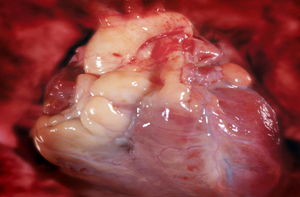 زيادة في الانتشار خاصة بين الشباب..امراض القلب تتسبب بـ 38% من الوفيات في الاردن