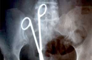 طبيبة تروي معايشتها معاناة مريضة..الأخطاء الطبية كثير من الإهمال... قليل من الصحة