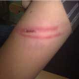 فضيحة في احد مدارس الأغوار الشمالية.. مدير مدرسة يجلد احد الطلاب بـ"بربيش غاز"