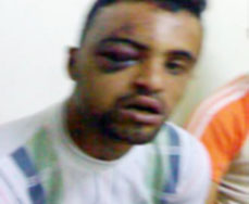 تحويل 3 من البحث الجنائي للتحقيق..الأمن ينفي الاعتداء على مواطن في الأغوار الشمالية