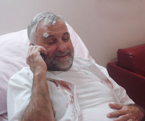 ليث شبيلات يؤكد للعراب نيوز تعرضه للضرب من قبل مجهولين صباح اليوم