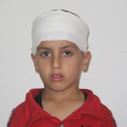 المفرق: سقوط درفة نافذة صف على رأس طالب