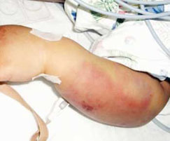 «الصحة» ترصد 2117 حالة عقر جديدة أغلبها لأطفال