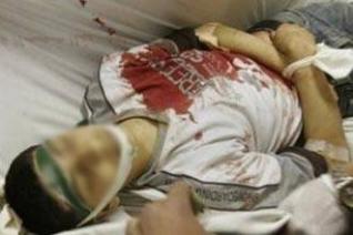 التلفزيون الإسرائيلي يؤكد سرقة أعضاء الموتى الفلسطينيين:كنا نفعل ذلك من أجل "التطور" العلمي!!!