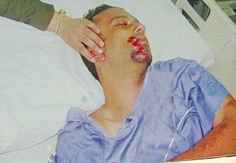 عاهد العلاونة.. حطموا رأسه وخسر حقوقه