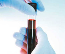 ارتفاع عدد الحاملين لجين الثلاسيميا في غور الصافي بشكل لافت