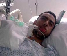 دخل مستشفى خاص في عمان لإجراء عملية تجميلية للأنف فغط في غيبوبة طويلة الأمد