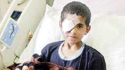 الطالب الدويكات يعاني من "هواء على الدماغ" وانفجار في العين