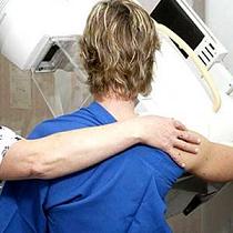 الجاعوني: سرطان الثدي يصيب سنويا 900 حالة جديدة في الأردن