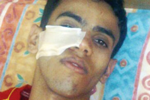 لاعب سعودي حاول ضرب الحكم.. فرد عليه بلكمة قاضية