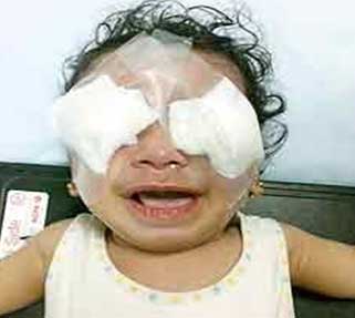 سيدة تسكب مادة "الكلوركس" في عين رضيعة ضرتها انتقاما منها