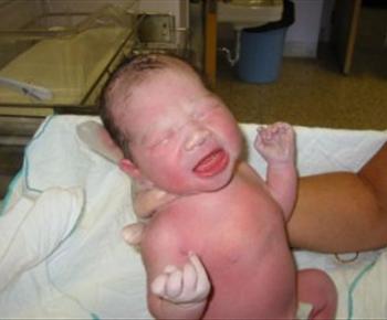 12 في المائة من حالات الوفاة لدى الأطفال في الأردن سببها التهابات الرئة