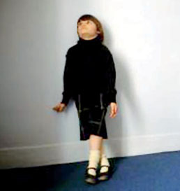 إحصائيات: "9000" طفل أردني مريض بالتوحد العقد القادم