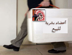 اليمن يتعقب 3 أردنيين متهمين بالاتجار بالأعضاء