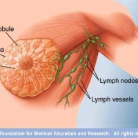 ارتفاع الإصابات بسرطان الثدي عند رجال الأردن عن النسب العالمية