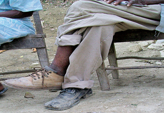 جنوبنا المتعب.. الفقر عندما يكون بعيدا عن الوسط