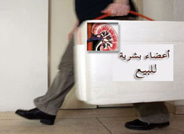 مصر: الأردن يتسلم مواطنا متهما بالاتجار بالاعضاء البشرية