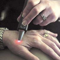 إغلاق العشرات من مراكز العلاج بالليزر لمخالفاتها الصحية