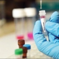 «الصحة» ترصد 391 إصابة بفيروس الكبد الوبائي منذ بداية العام الحالي