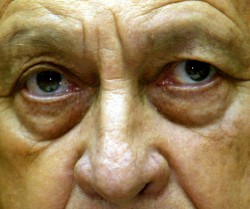 موت شارون بعد غيبوبة دامت ثلاث سنوات