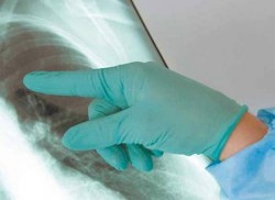 جرثومة جديدة مقاومة للمضادات أصلها آسيا تجتاح العالم