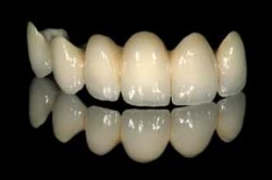 سيدة تنجو بأعجوبة من الاختناق جراء ابتلاعها ست أسنان