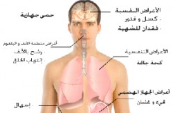 50 مليون دينار تكلفة تقديرية لعلاج الالتهابات الرئوية