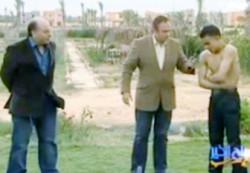 "شاهدوا بالفيديو".. مصري يخرج عموده الفقري من بطنه