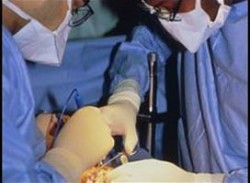 يسرق كلية زوجته ويبيعها بعد أن أوهمها باجراء  تحاليل طبية