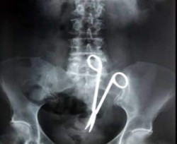 التنسيب بإحالة طبيبين الى النائب العام بتهمة الاهمال والتقصير