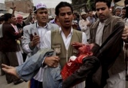 قناصة يحدثون مجزرة بساحة التغيير في صنعاء ويخلفون عشرات الضحايا