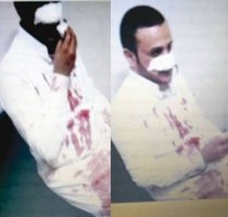 سعوديان يشتكيان لسفارة بلدهما عن ضربهما باربد