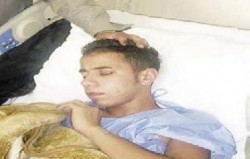 شاب يدخل في غيبوبة بعد سقوط عارضة مرمى كرة قدم على رأسه في مادبا