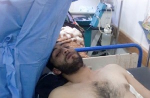 عشرات الجرحى الليبيين يصلون الاردن «17» منهم في العناية الحثيثة