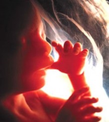 إربد : طبيب يجرح جنينا في رأسه خلال عملية قيصرية