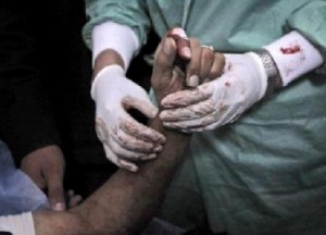 13 ألف مريض ليبي يغلقون مستشفيات المملكة أمام الأردنيين