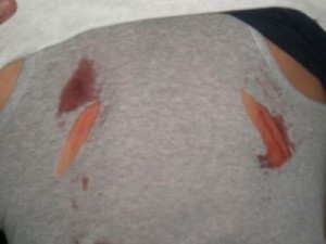 ملابس الناشط الضمور انقذت حياته من طعنتين