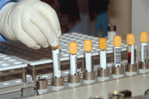 وفاة مواطن اثناء مراجعته مختبرا طبيا في الرصيفة