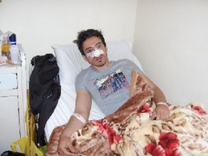 طالب وذووه يعتدون بالضرب المبرح على معلم في إربد