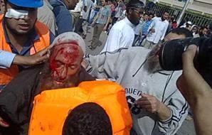 مصر : 8 إصابات فى اشتباكات وزارة الدفاع