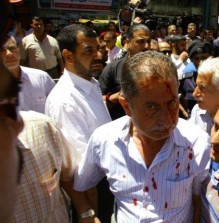 مشاجرة حامية الوطيس مابين  التيار 36 وحزب الوحدة في مسير ة اليوم والسبب من سيقف بجانب حمزة منصور