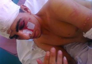 مصدر امني ينفي اعتداء الدرك على الشاب "القلالوة"