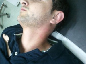 مواطن يتهم رجال أمن بالاعتداء عليه