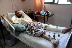 19 جريحاً سورياً في مستشفى الرمثا فجراً